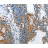 Immunohistochemistry - RARRES3 Antibody from Signalway Antibody (35961) - Antibodies.com