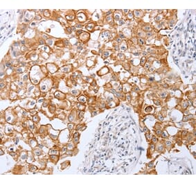Immunohistochemistry - TNFAIP1 Antibody from Signalway Antibody (35962) - Antibodies.com