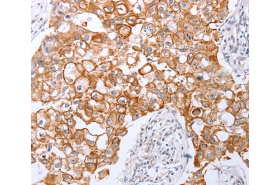 Immunohistochemistry - TNFAIP1 Antibody from Signalway Antibody (35962) - Antibodies.com