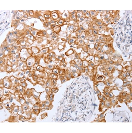 Immunohistochemistry - TNFAIP1 Antibody from Signalway Antibody (35962) - Antibodies.com