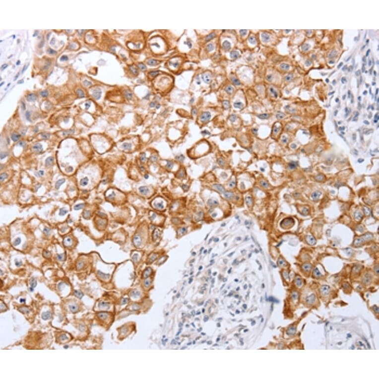 Immunohistochemistry - TNFAIP1 Antibody from Signalway Antibody (35962) - Antibodies.com
