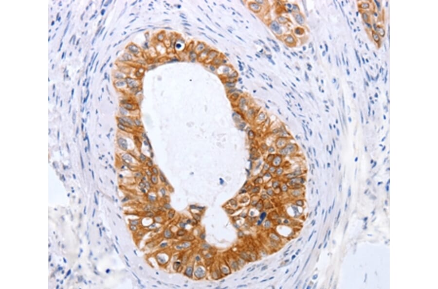 Immunohistochemistry - TNFAIP1 Antibody from Signalway Antibody (35962) - Antibodies.com
