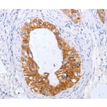 Immunohistochemistry - TNFAIP1 Antibody from Signalway Antibody (35962) - Antibodies.com