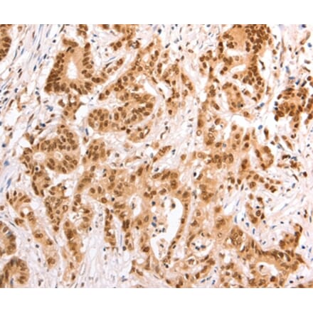 Immunohistochemistry - TAX1BP1 Antibody from Signalway Antibody (35972) - Antibodies.com