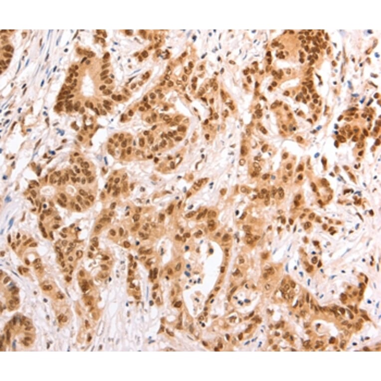 Immunohistochemistry - TAX1BP1 Antibody from Signalway Antibody (35972) - Antibodies.com