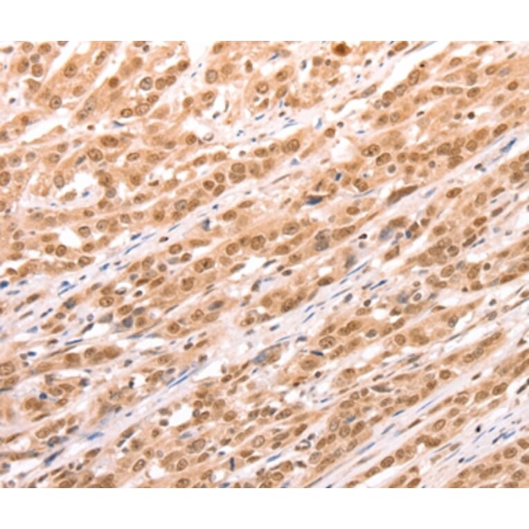 Immunohistochemistry - TAX1BP1 Antibody from Signalway Antibody (35972) - Antibodies.com