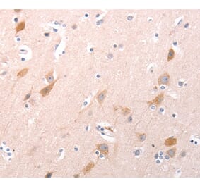 Immunohistochemistry - C1QTNF6 Antibody from Signalway Antibody (35977) - Antibodies.com
