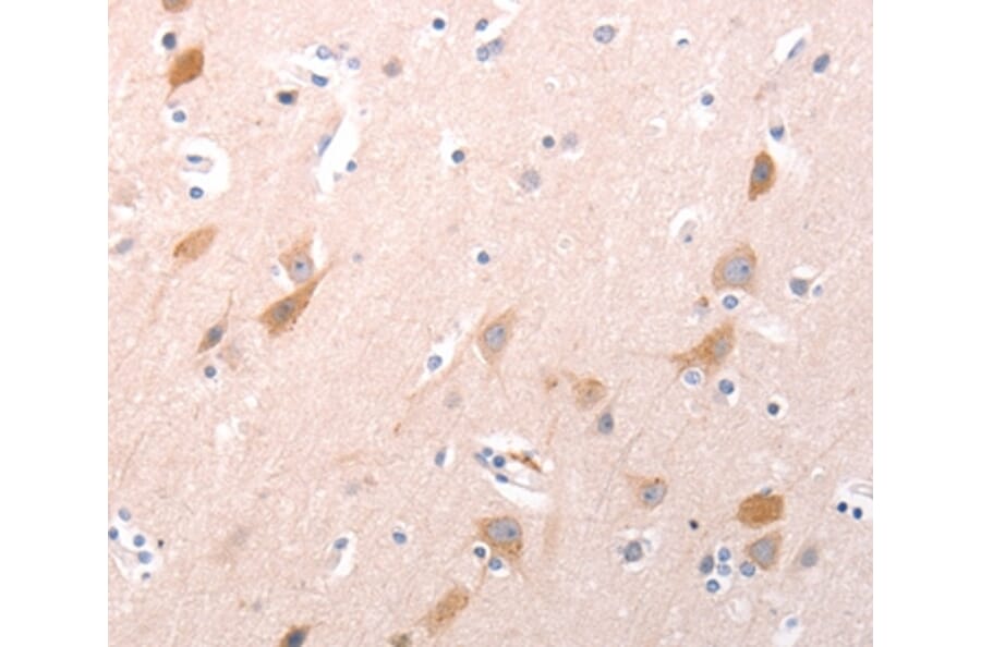 Immunohistochemistry - C1QTNF6 Antibody from Signalway Antibody (35977) - Antibodies.com