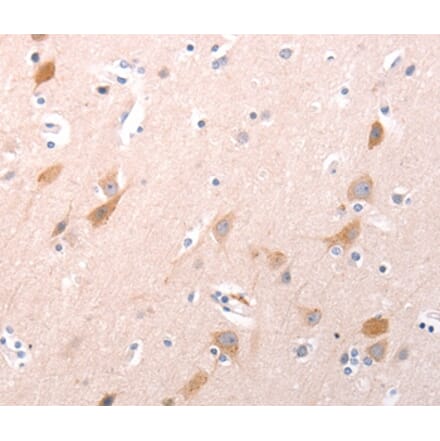 Immunohistochemistry - C1QTNF6 Antibody from Signalway Antibody (35977) - Antibodies.com