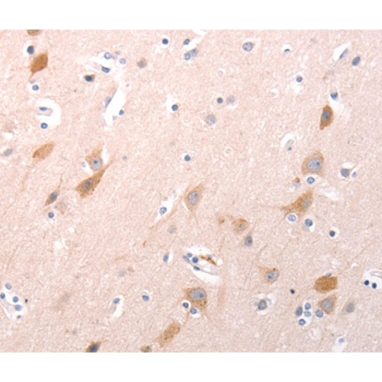 Immunohistochemistry - C1QTNF6 Antibody from Signalway Antibody (35977) - Antibodies.com