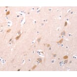 Immunohistochemistry - C1QTNF6 Antibody from Signalway Antibody (35977) - Antibodies.com