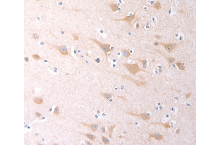 Immunohistochemistry - SCGB1A1 Antibody from Signalway Antibody (35982) - Antibodies.com