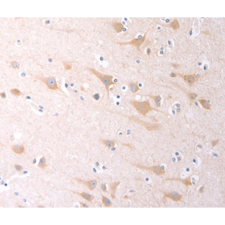 Immunohistochemistry - SCGB1A1 Antibody from Signalway Antibody (35982) - Antibodies.com