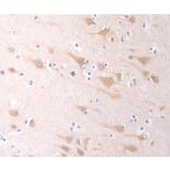 Immunohistochemistry - SCGB1A1 Antibody from Signalway Antibody (35982) - Antibodies.com