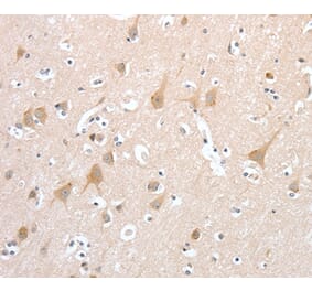 Immunohistochemistry - PCDHB16 Antibody from Signalway Antibody (35994) - Antibodies.com