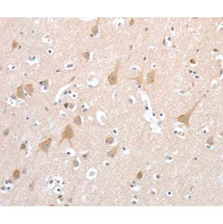 Immunohistochemistry - PCDHB16 Antibody from Signalway Antibody (35994) - Antibodies.com