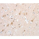 Immunohistochemistry - PCDHB16 Antibody from Signalway Antibody (35994) - Antibodies.com