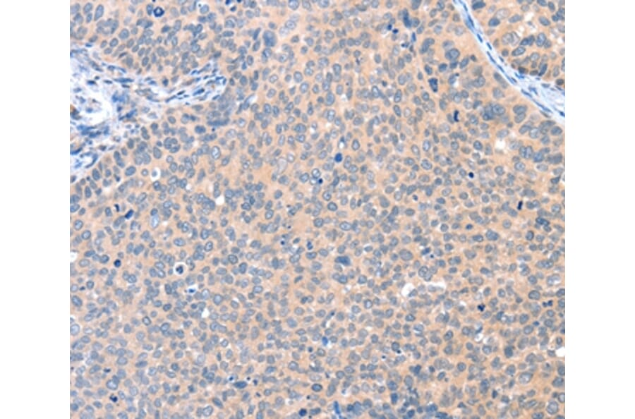 Immunohistochemistry - AADACL2 Antibody from Signalway Antibody (36002) - Antibodies.com
