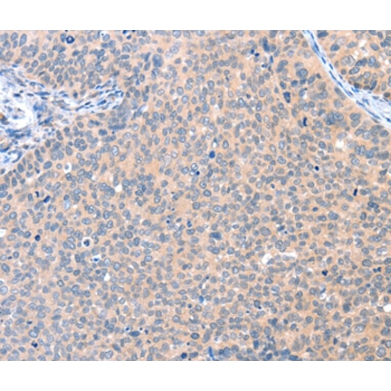 Immunohistochemistry - AADACL2 Antibody from Signalway Antibody (36002) - Antibodies.com