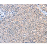 Immunohistochemistry - AADACL2 Antibody from Signalway Antibody (36002) - Antibodies.com
