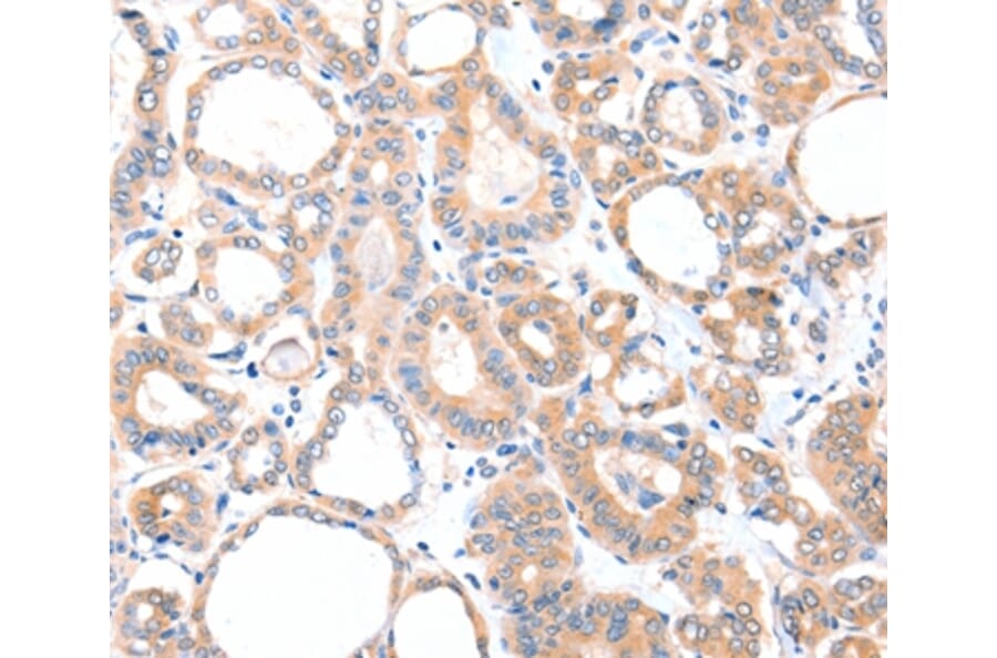 Immunohistochemistry - AADACL2 Antibody from Signalway Antibody (36002) - Antibodies.com