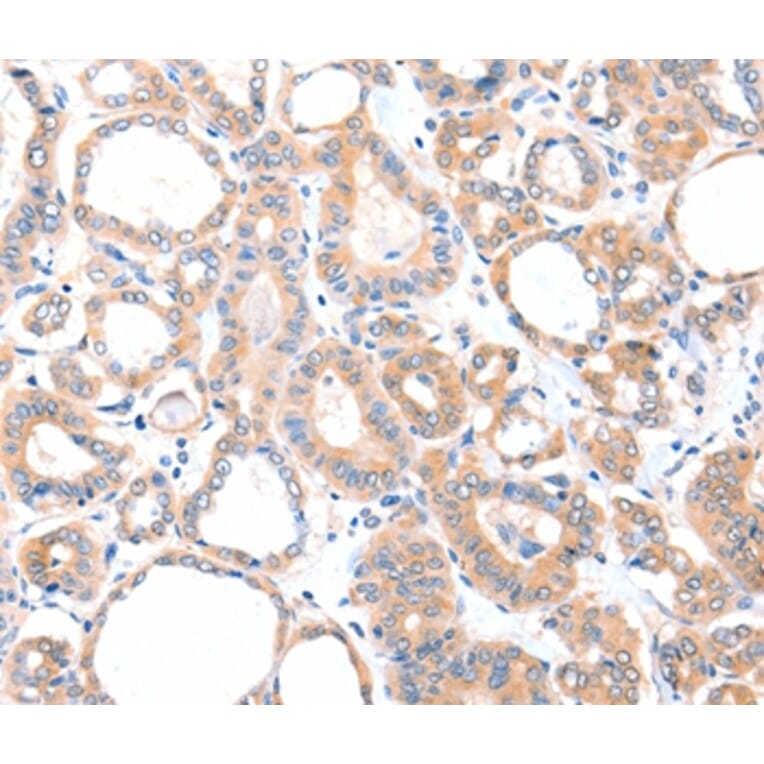Immunohistochemistry - AADACL2 Antibody from Signalway Antibody (36002) - Antibodies.com