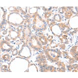 Immunohistochemistry - AADACL2 Antibody from Signalway Antibody (36002) - Antibodies.com