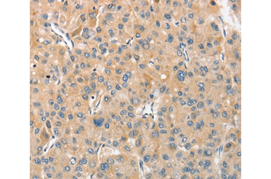 Immunohistochemistry - ANGPTL7 Antibody from Signalway Antibody (36102) - Antibodies.com