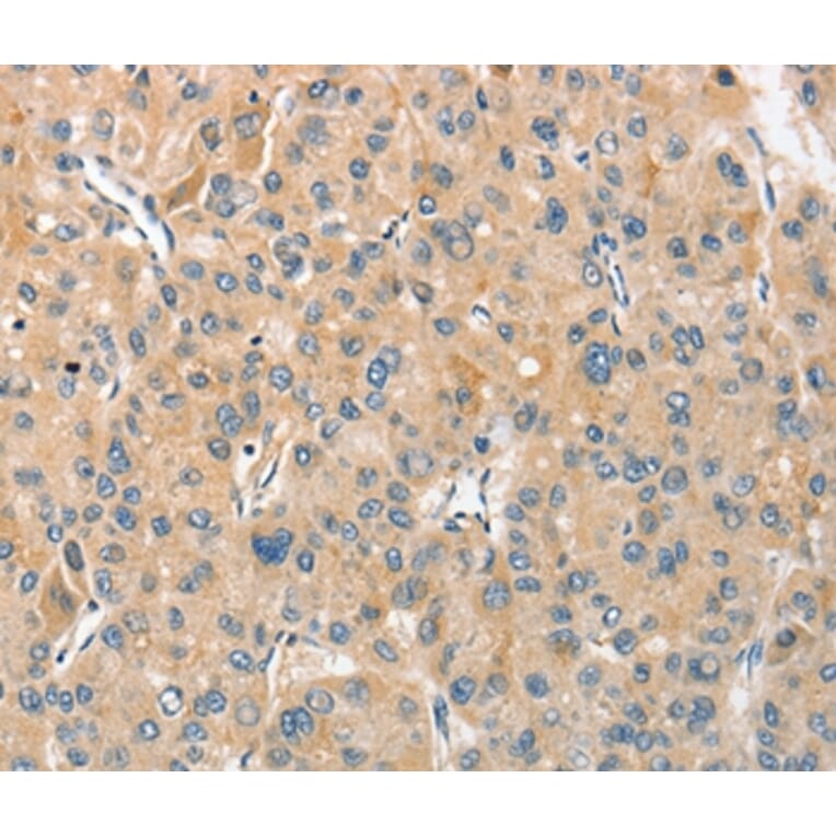 Immunohistochemistry - ANGPTL7 Antibody from Signalway Antibody (36102) - Antibodies.com