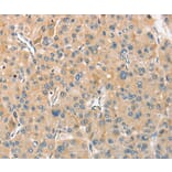 Immunohistochemistry - ANGPTL7 Antibody from Signalway Antibody (36102) - Antibodies.com