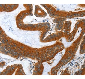 Immunohistochemistry - ANAPC10 Antibody from Signalway Antibody (36112) - Antibodies.com