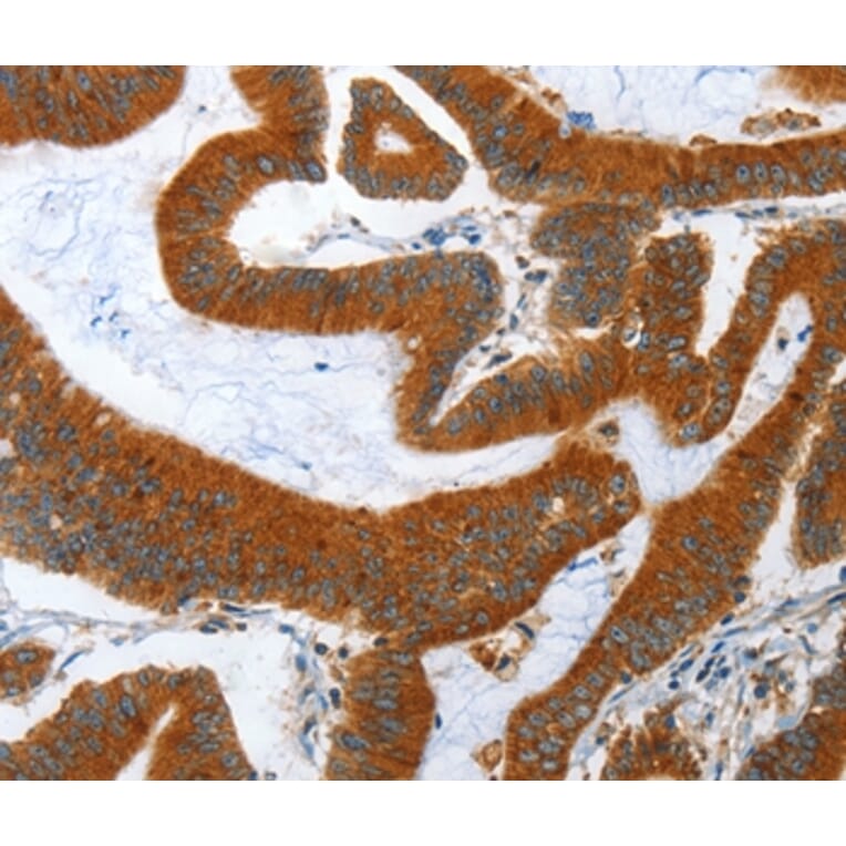 Immunohistochemistry - ANAPC10 Antibody from Signalway Antibody (36112) - Antibodies.com