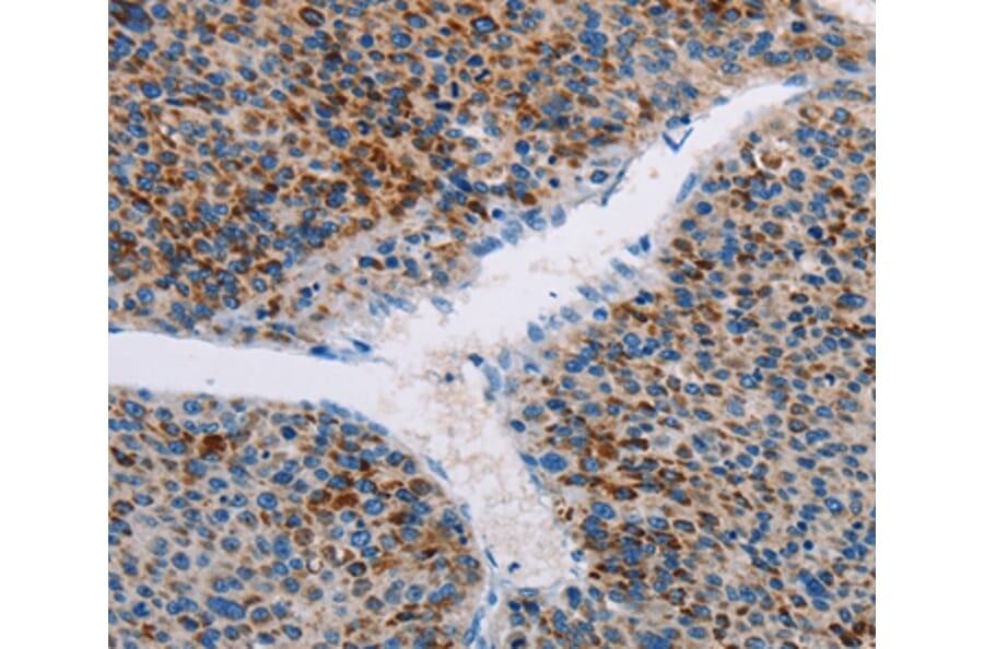 Immunohistochemistry - APOBEC4 Antibody from Signalway Antibody (36120) - Antibodies.com