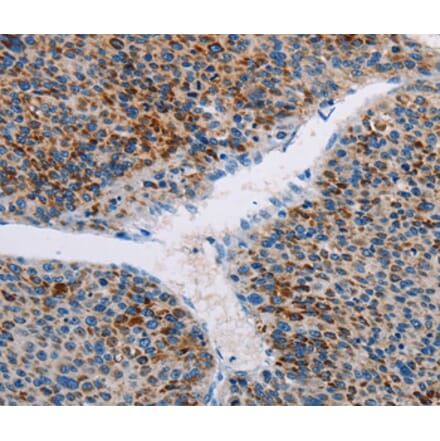 Immunohistochemistry - APOBEC4 Antibody from Signalway Antibody (36120) - Antibodies.com