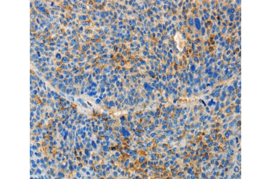 Immunohistochemistry - TNFSF13 Antibody from Signalway Antibody (36124) - Antibodies.com