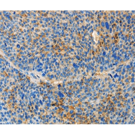 Immunohistochemistry - TNFSF13 Antibody from Signalway Antibody (36124) - Antibodies.com