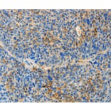 Immunohistochemistry - TNFSF13 Antibody from Signalway Antibody (36124) - Antibodies.com