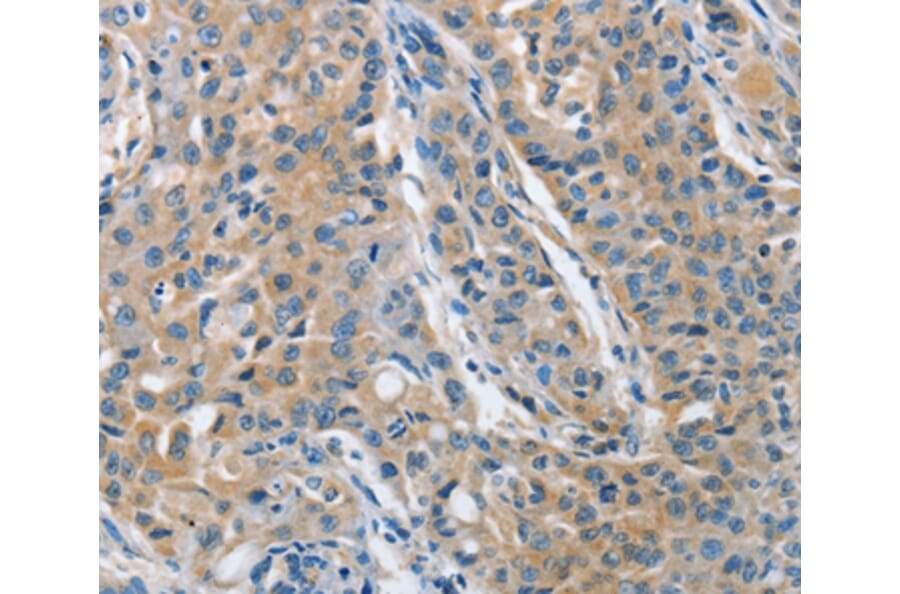 Immunohistochemistry - TNFSF13 Antibody from Signalway Antibody (36124) - Antibodies.com