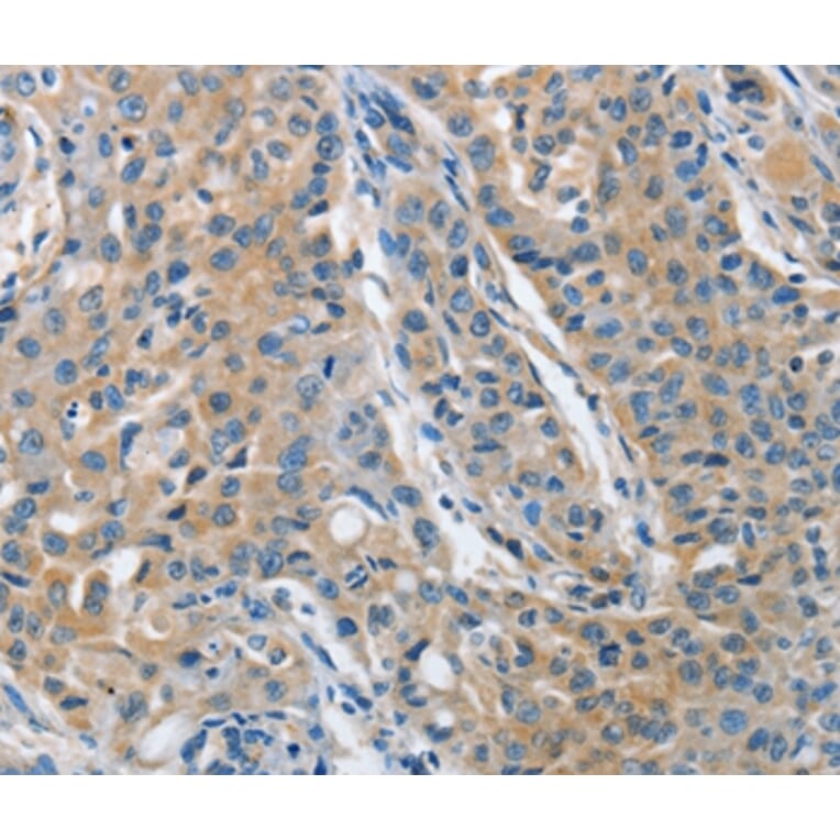 Immunohistochemistry - TNFSF13 Antibody from Signalway Antibody (36124) - Antibodies.com