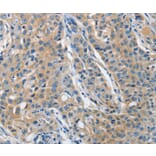 Immunohistochemistry - TNFSF13 Antibody from Signalway Antibody (36124) - Antibodies.com