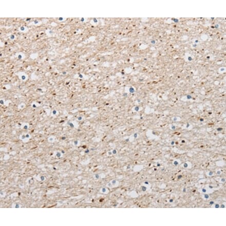 Immunohistochemistry - ARHGAP1 Antibody from Signalway Antibody (36129) - Antibodies.com
