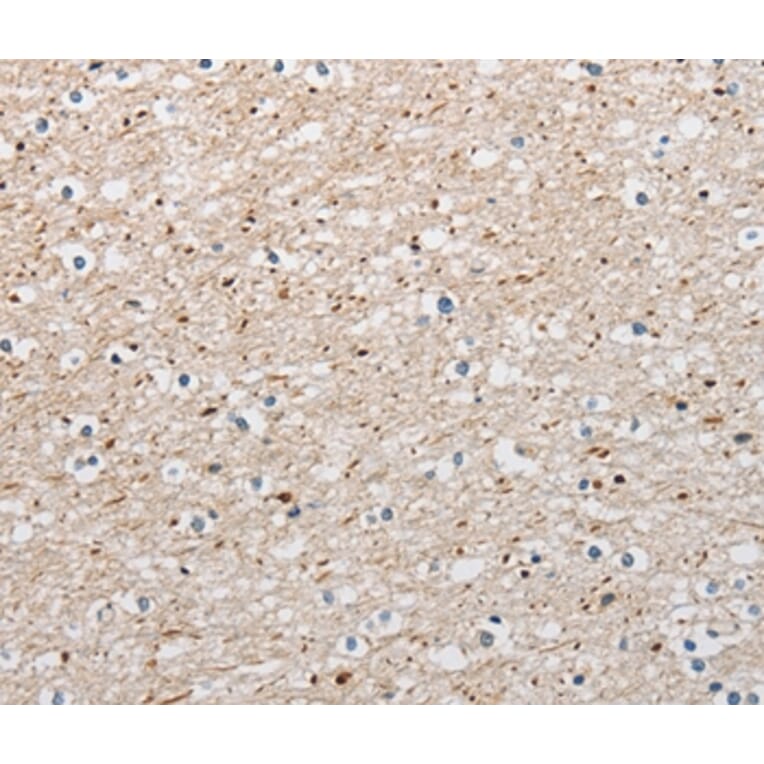 Immunohistochemistry - ARHGAP1 Antibody from Signalway Antibody (36129) - Antibodies.com