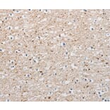 Immunohistochemistry - ARHGAP1 Antibody from Signalway Antibody (36129) - Antibodies.com