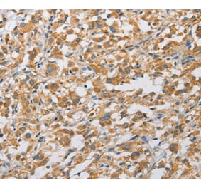 Immunohistochemistry - ARHGAP5 Antibody from Signalway Antibody (36130) - Antibodies.com