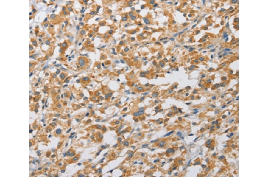 Immunohistochemistry - ARHGAP5 Antibody from Signalway Antibody (36130) - Antibodies.com