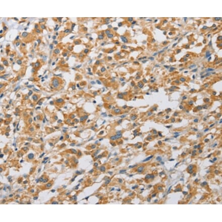 Immunohistochemistry - ARHGAP5 Antibody from Signalway Antibody (36130) - Antibodies.com