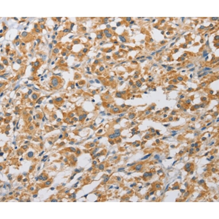 Immunohistochemistry - ARHGAP5 Antibody from Signalway Antibody (36130) - Antibodies.com