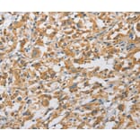 Immunohistochemistry - ARHGAP5 Antibody from Signalway Antibody (36130) - Antibodies.com