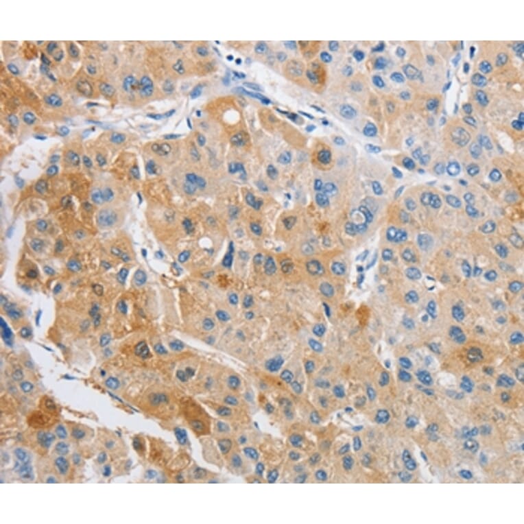 Immunohistochemistry - ARHGAP5 Antibody from Signalway Antibody (36130) - Antibodies.com