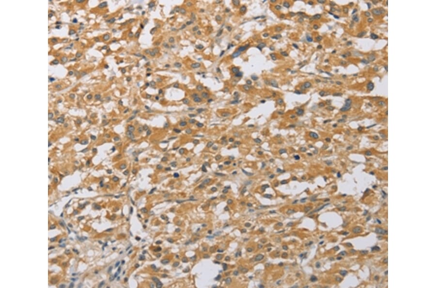 Immunohistochemistry - ARHGEF1 Antibody from Signalway Antibody (36133) - Antibodies.com